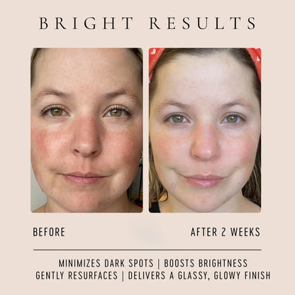 Vitamin C Glow Drops
