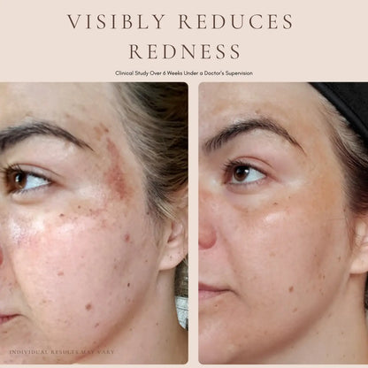 Luxury Beauty Serum